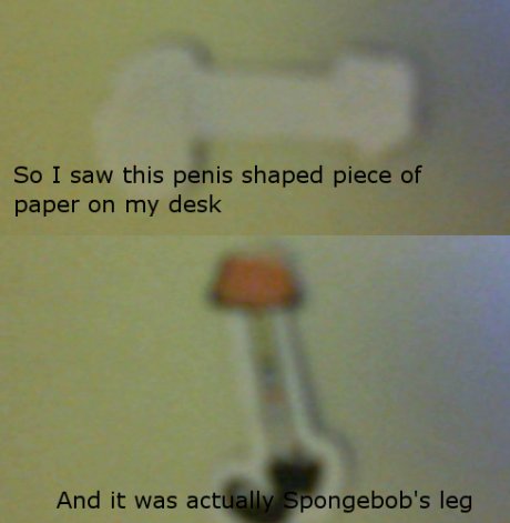 My Leg!
