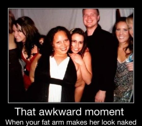 That Fat Arm